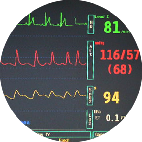 Monitoraggio emodinamico