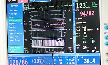 Arterial pressure trends during anaesthesia